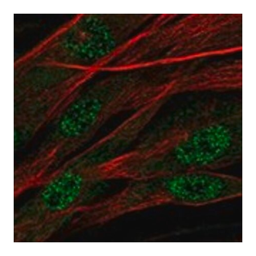 Merck Anti-ASPN antibody produced in rabbit