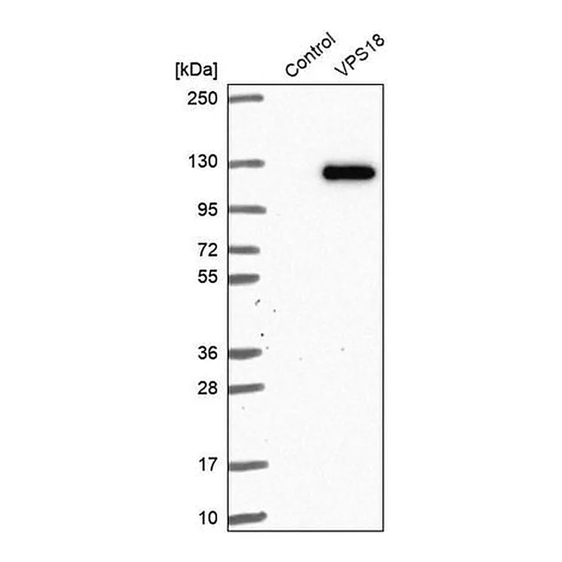Merck Anti-VPS18 antibody produced in rabbit