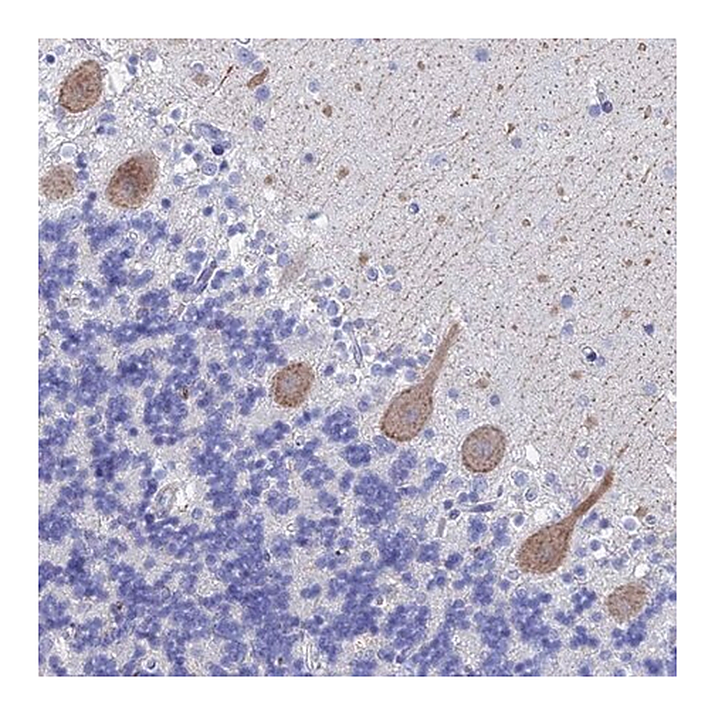 Merck Anti-KCNK18 antibody produced in rabbit