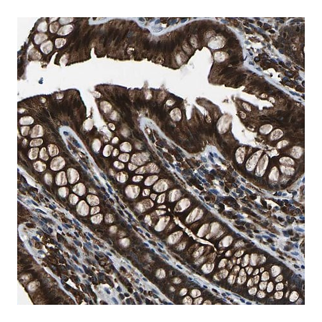 Merck Anti-SCAMP2 antibody produced in rabbit