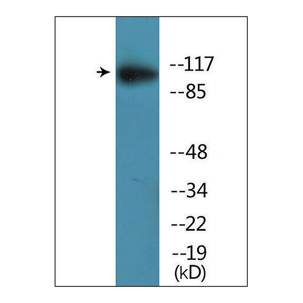Merck Anti-phospho-MER/SKY (pTyr749/681) antibody produced in rabbit