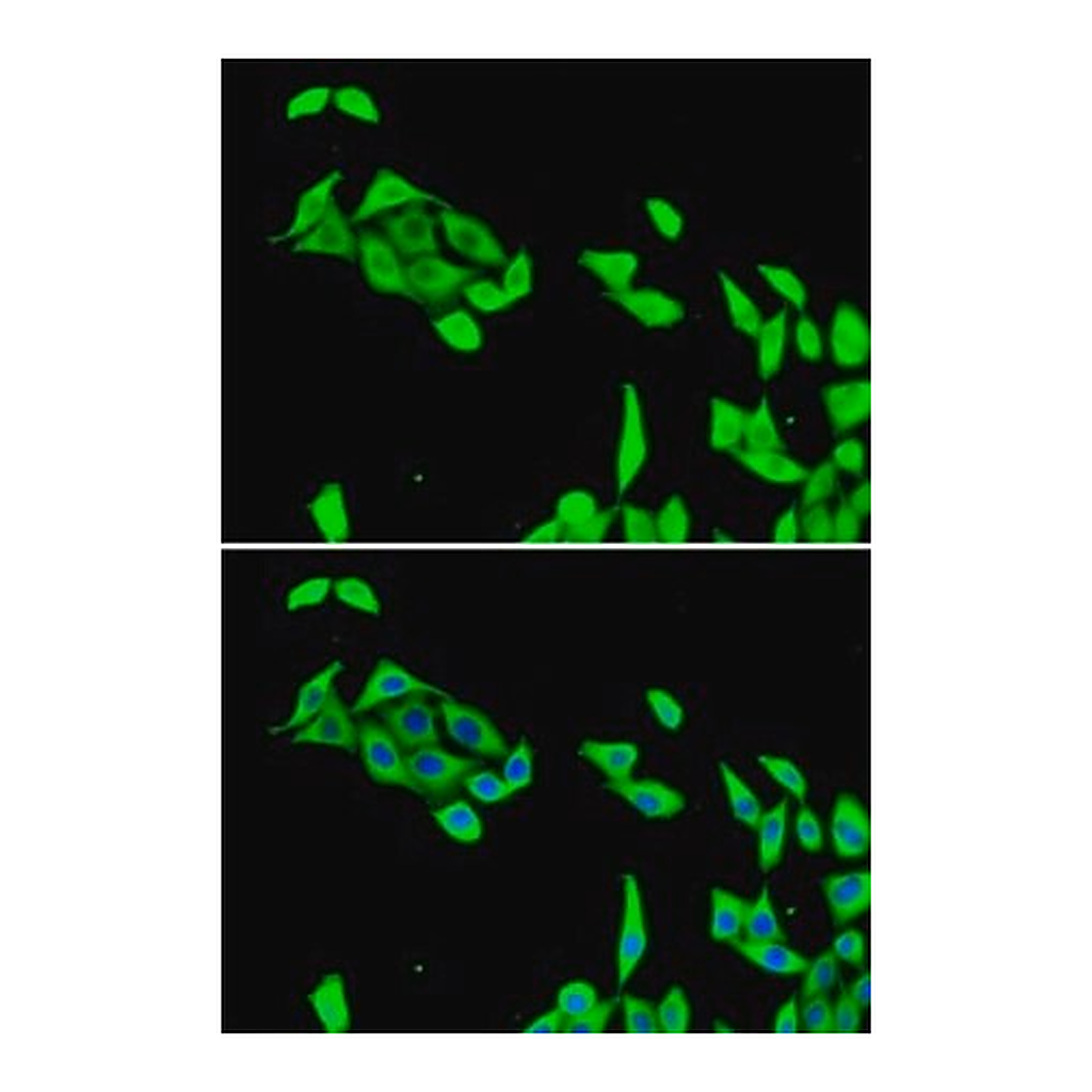 Merck Anti-CDK5 antibody produced in rabbit