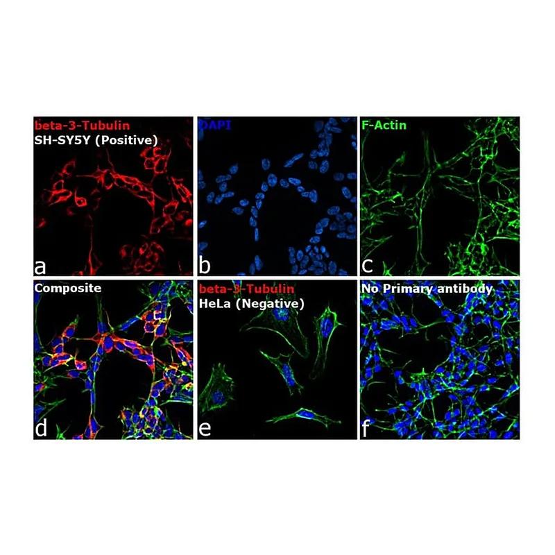 Thermo Fisher Scientific Goat anti-Mouse IgG2a Cross-Adsorbed Secondary Antibody, Alexa Fluor 555