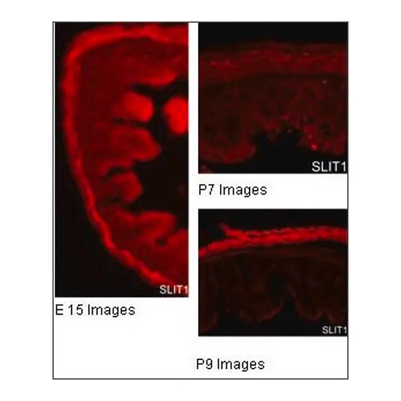 Merck Anti-SLIT1 antibody produced in rabbit