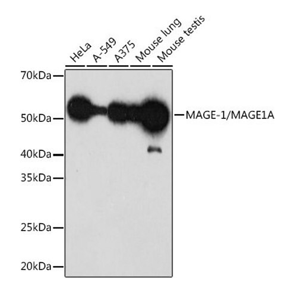 Merck Anti-MAGE-1/MAGE1A antibody produced in rabbit