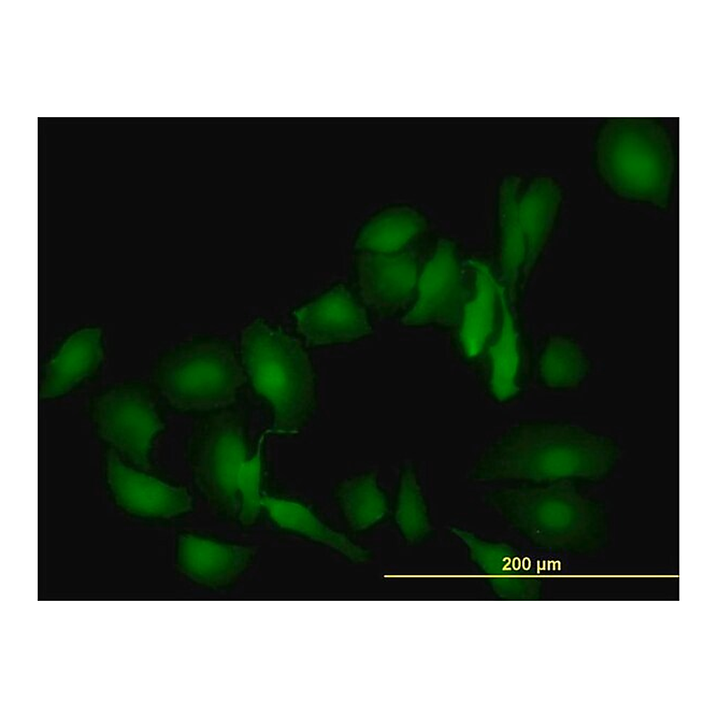Merck Monoclonal Anti-LGALS1 antibody produced in mouse