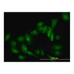 Merck Monoclonal Anti-LGALS1 antibody produced in mouse