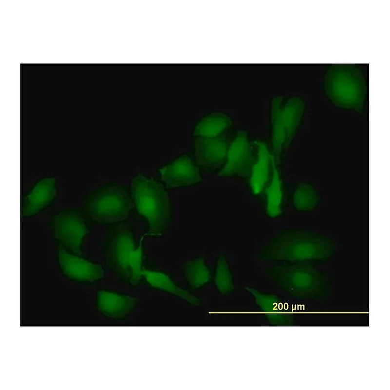 Merck Monoclonal Anti-LGALS1 antibody produced in mouse
