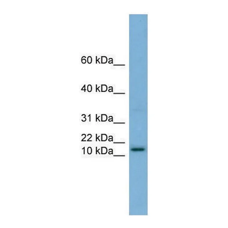 Merck Anti-HRK (N-terminal) antibody produced in rabbit