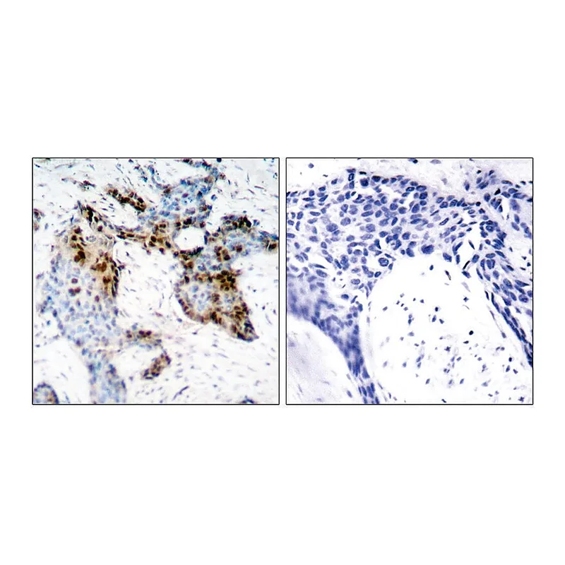 Merck Anti-Estrogen Receptor-alpha antibody produced in rabbit