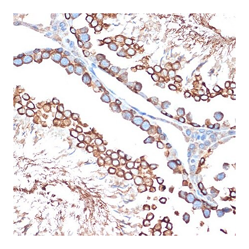 Merck Anti-ACVR1B antibody produced in rabbit
