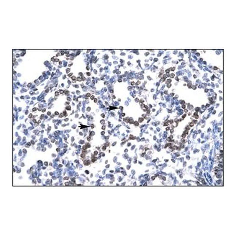 Merck Anti-HEY1
