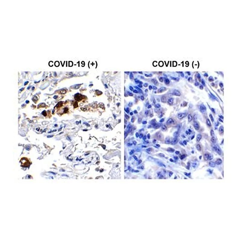 Merck Anti-SARS-CoV-2 (COVID-19) Spike RBD &