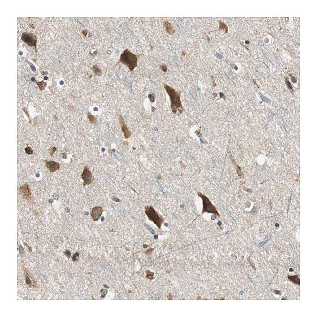 Merck Anti-CNOT3 antibody produced in rabbit