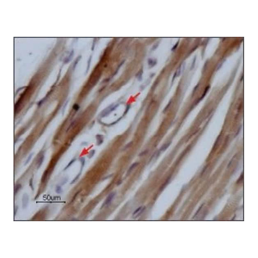Merck Anti-Sodium Channel NaV1.5 antibody produced in rabbit