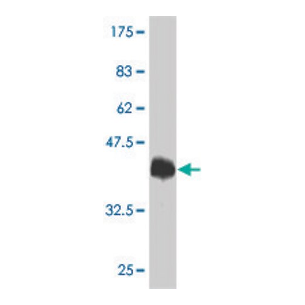 Merck Monoclonal Anti-TRPV1 antibody produced in mouse
