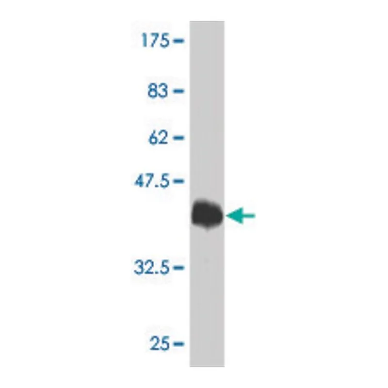 Merck Monoclonal Anti-TRPV1 antibody produced in mouse