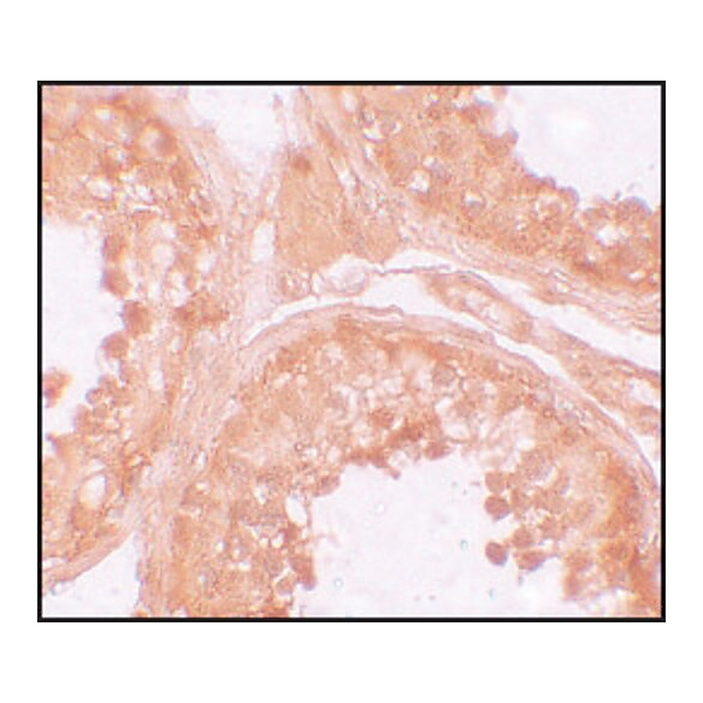 Merck Anti-NOD6 antibody produced in rabbit