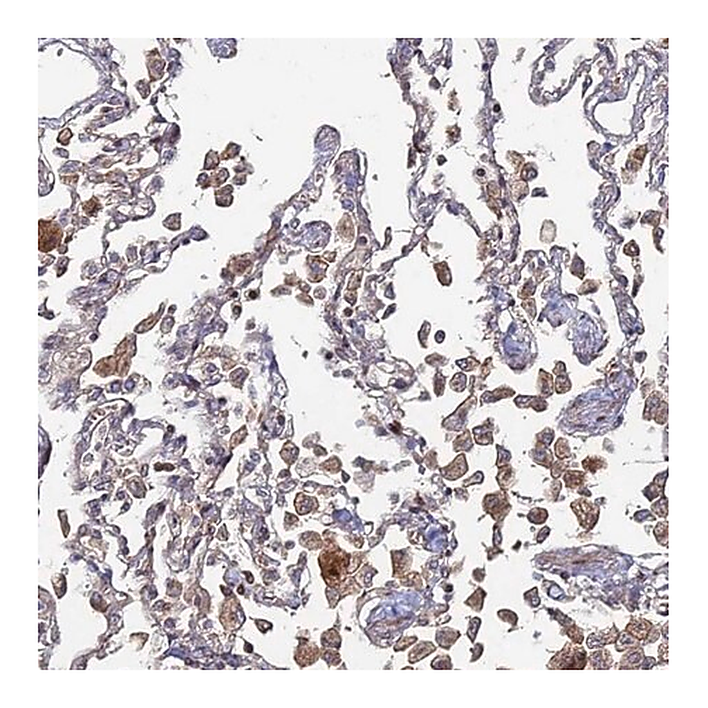 Merck Anti-SGMS1 antibody produced in rabbit