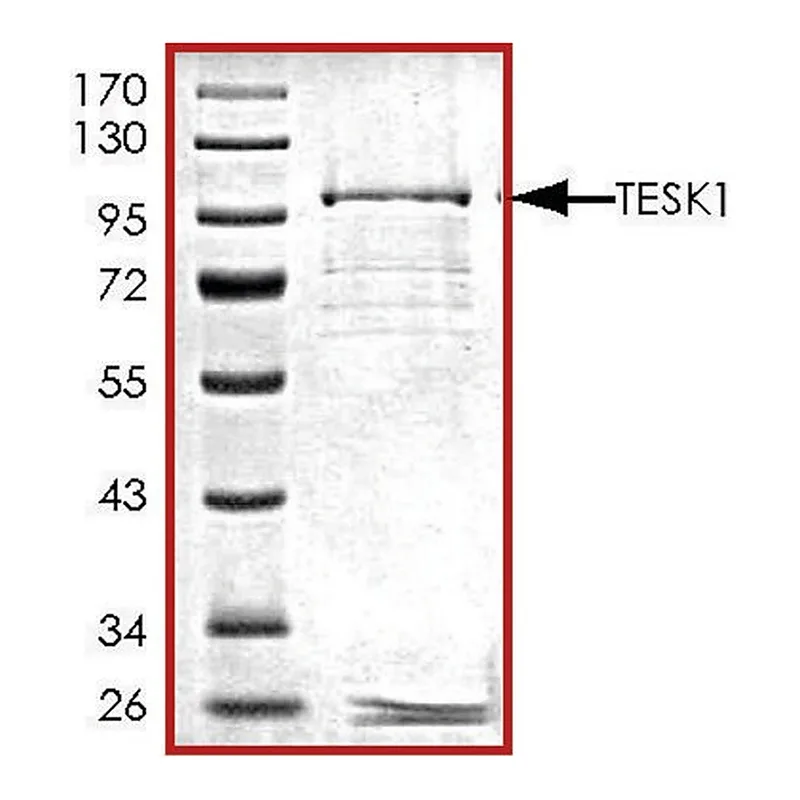 Merck TESK1, GST tagged human