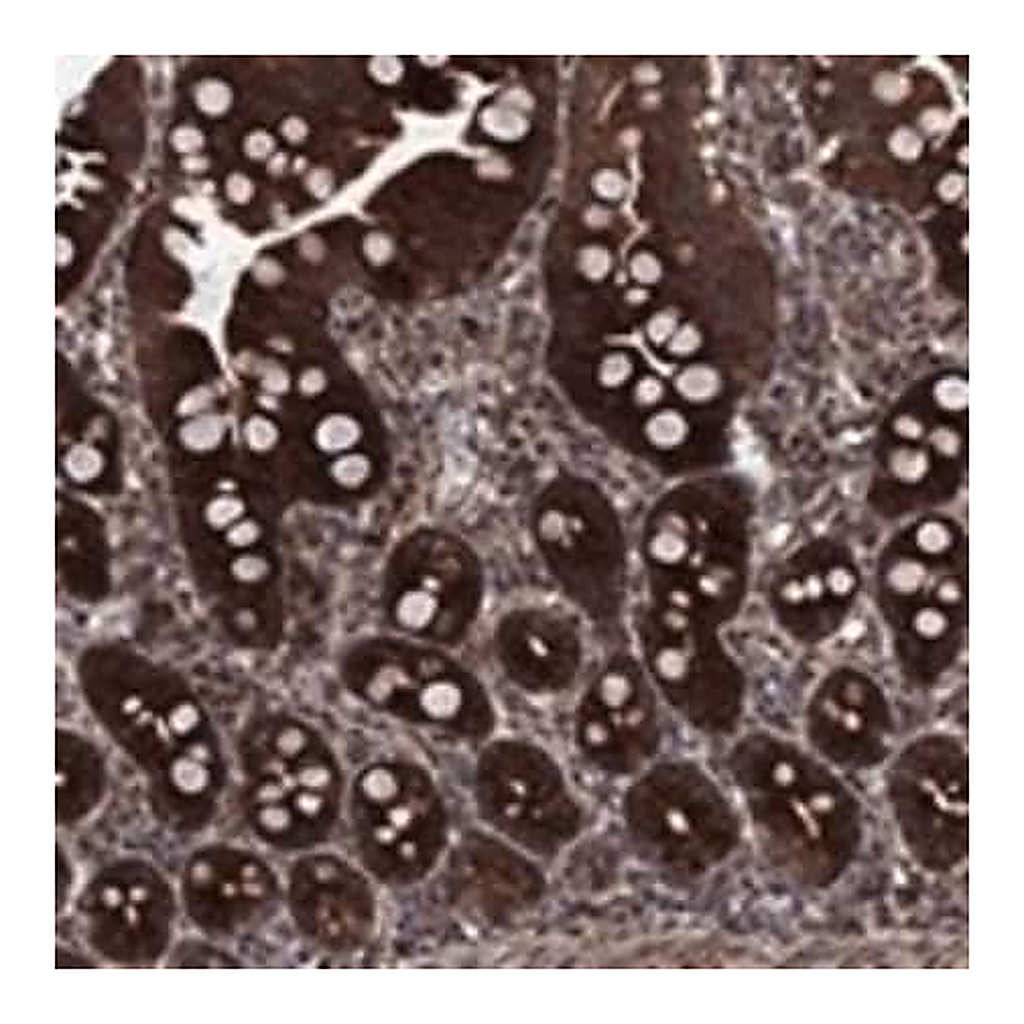 Merck Anti-HDAC4 antibody produced in rabbit