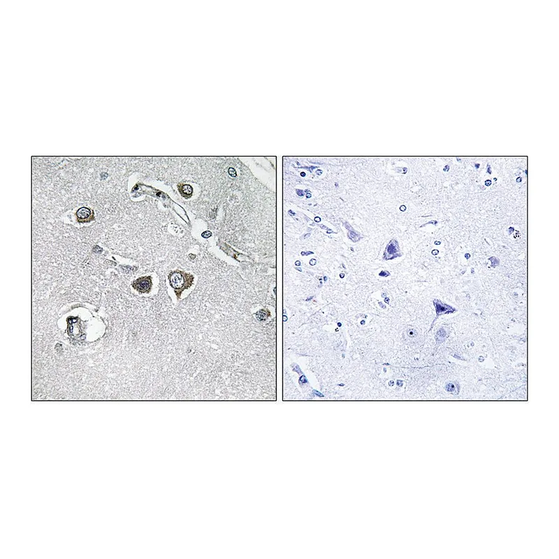 Merck Anti-Collagen XI alpha2 antibody produced in rabbit