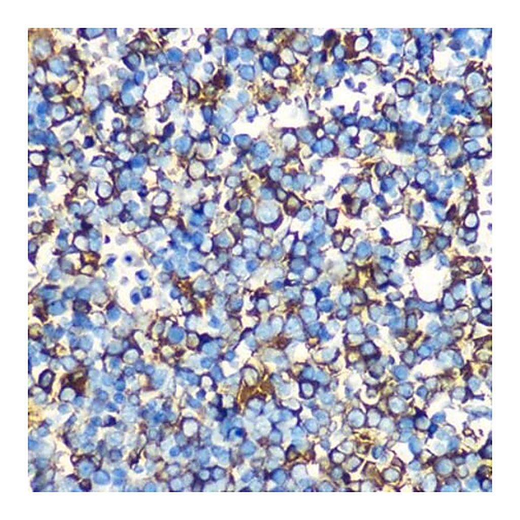 Merck Anti-Alpha-Fetoprotein (AFP) antibody produced in mouse