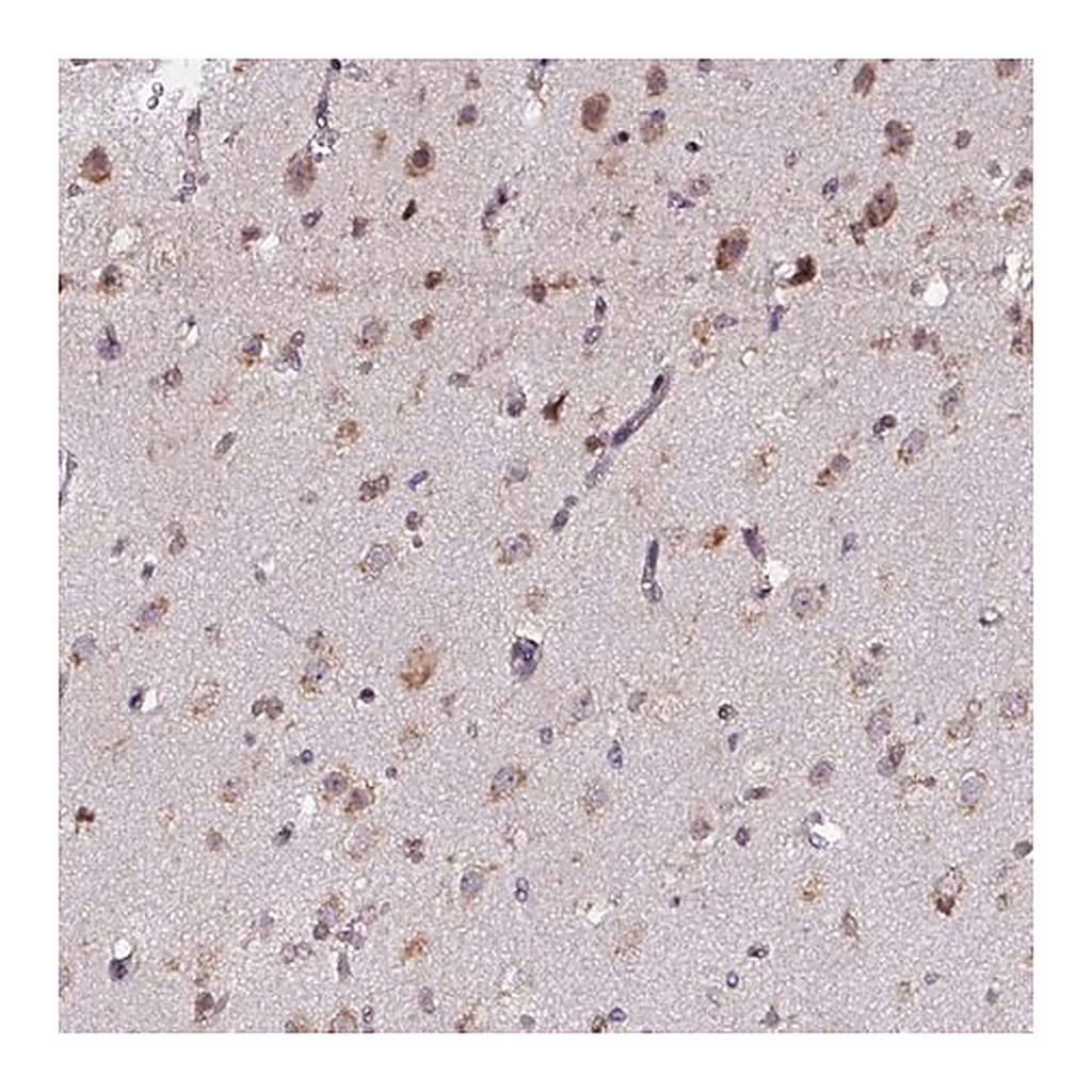 Merck Anti-APOLD1 antibody produced in rabbit
