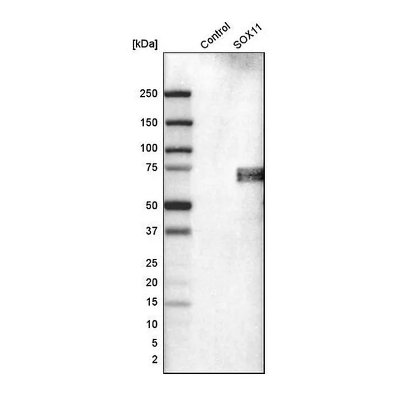 Merck Monoclonal Anti-SOX11 antibody produced in mouse