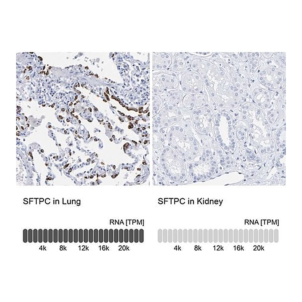 Merck Anti-SFTPC antibody produced in rabbit