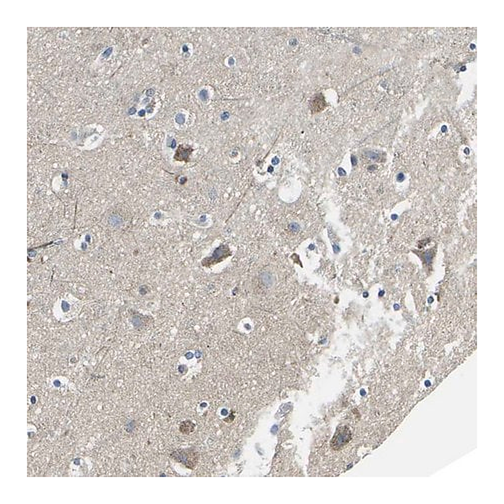 Merck Anti-TMEFF2 antibody produced in rabbit