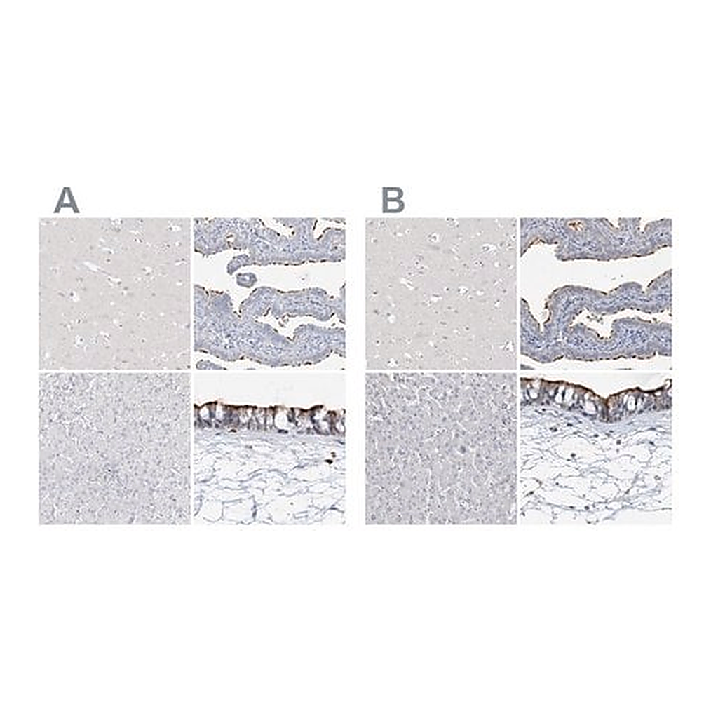 Merck Anti-DNAH5 antibody produced in rabbit