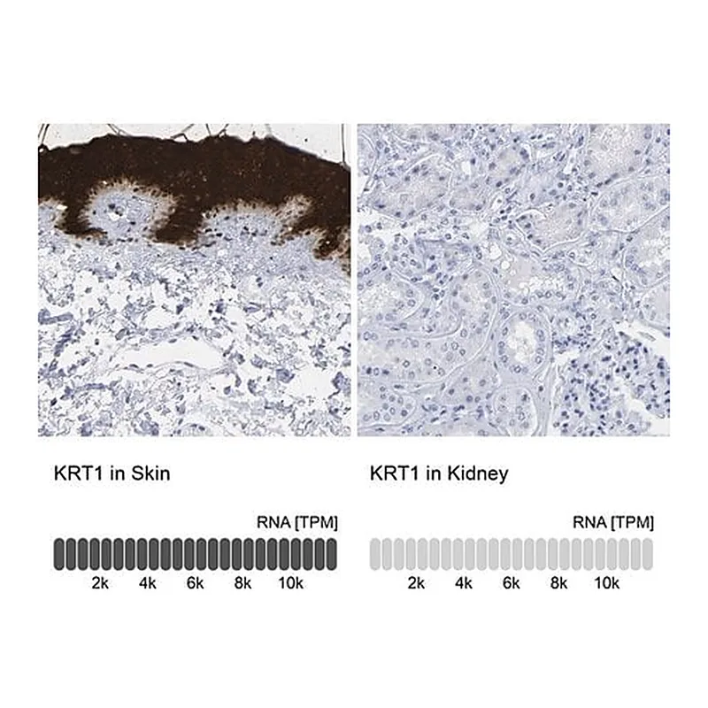 Merck Anti-KRT1 antibody produced in rabbit