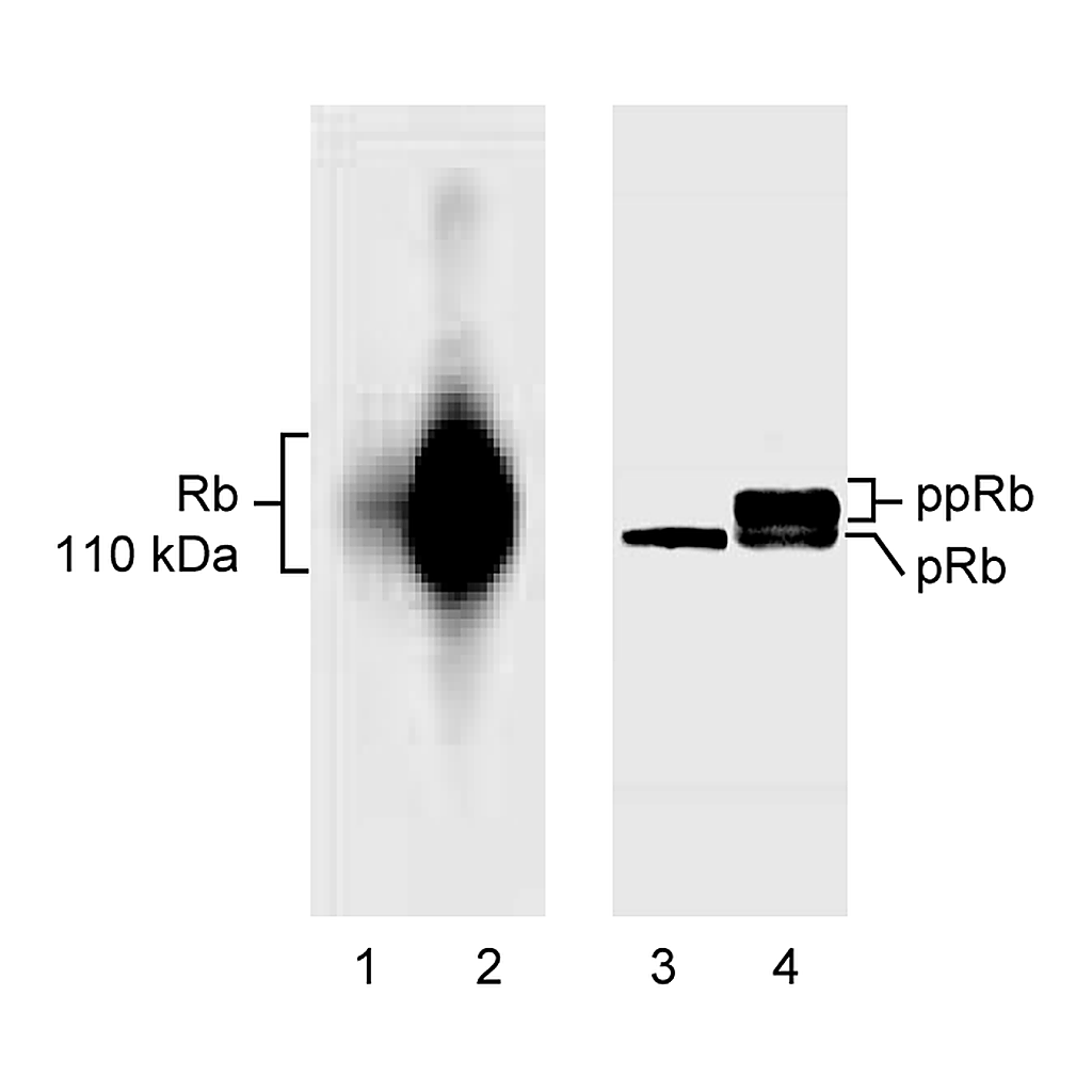 BD Purified Mouse Anti-Human Underphosphorylated Retinoblastoma Protein (RB)