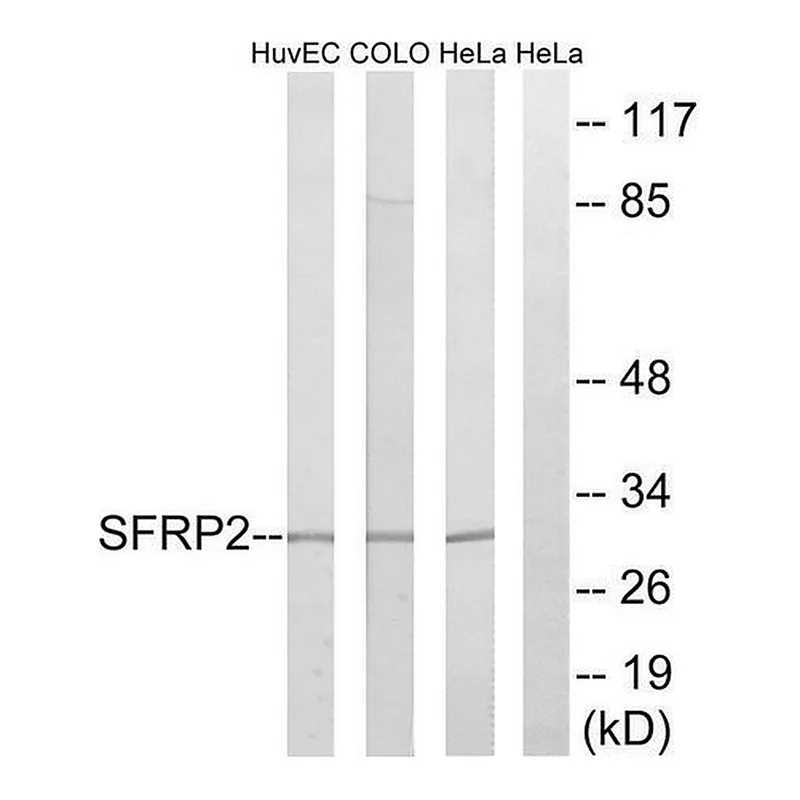 Merck Anti-SFRP2 antibody produced in rabbit