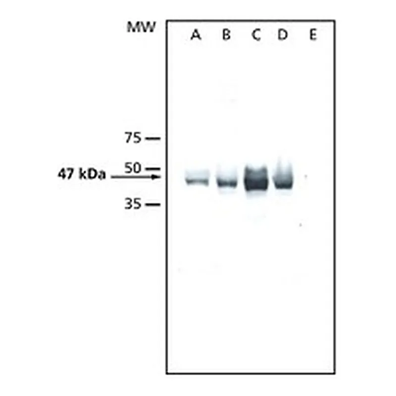 Merck ANTI-ATMPK6