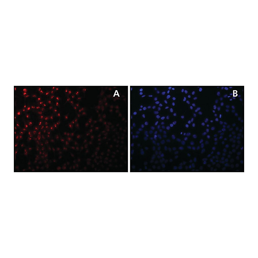 Merck Anti-Sirt7 antibody produced in rabbit