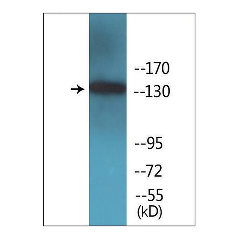 Merck Anti-phospho-IRS-1 (pSer1101) antibody produced in rabbit