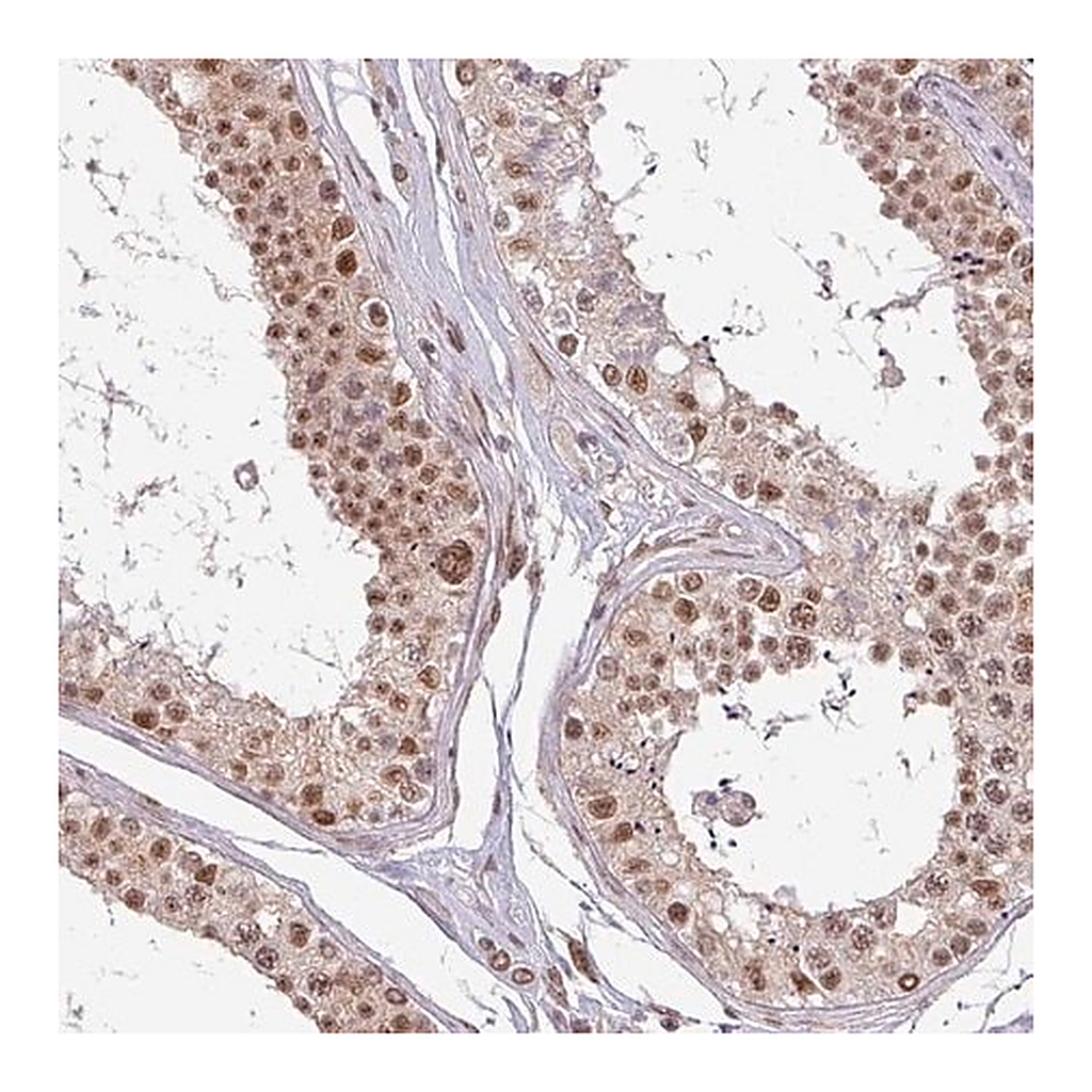 Merck Anti-PTPN20 antibody produced in rabbit