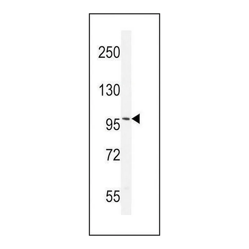 Merck ANTI-ANDROGEN RECEPTOR (ANDR) antibody produced in rabbit