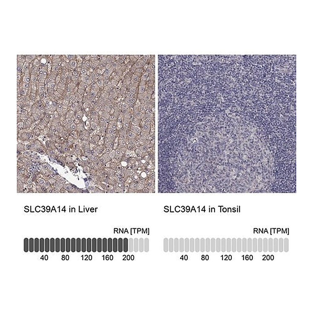 Merck Anti-SLC39A14 antibody produced in rabbit
