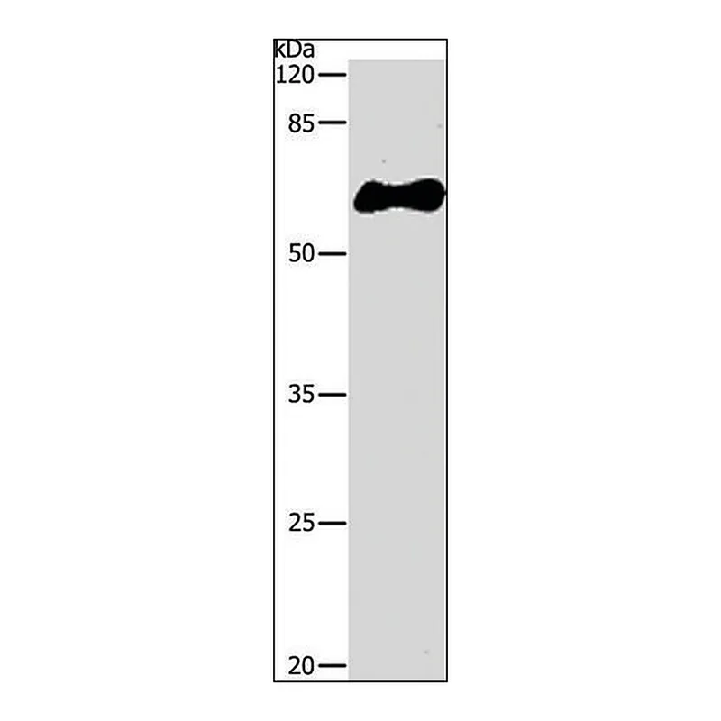 Merck Anti-GST Tag antibody produced in rabbit