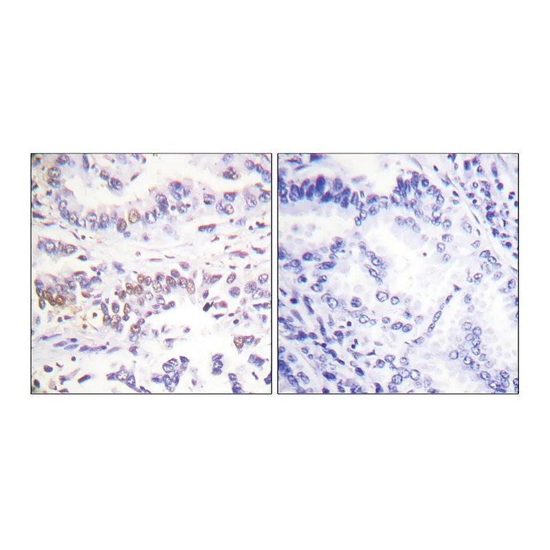 Merck Anti-XRCC3 antibody produced in rabbit