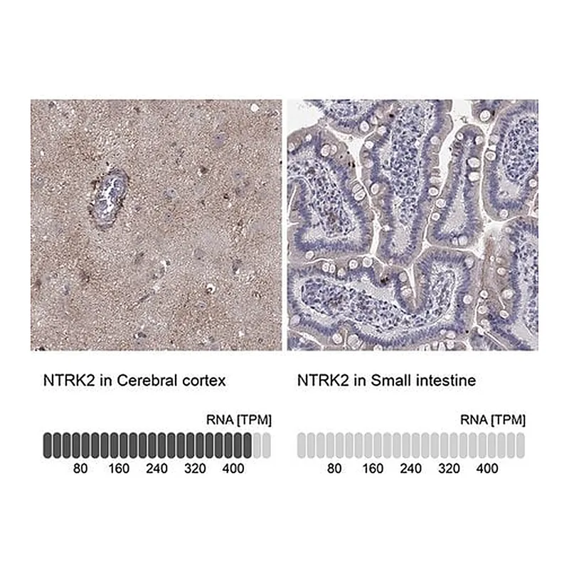 Merck Anti-NTRK2 antibody produced in rabbit