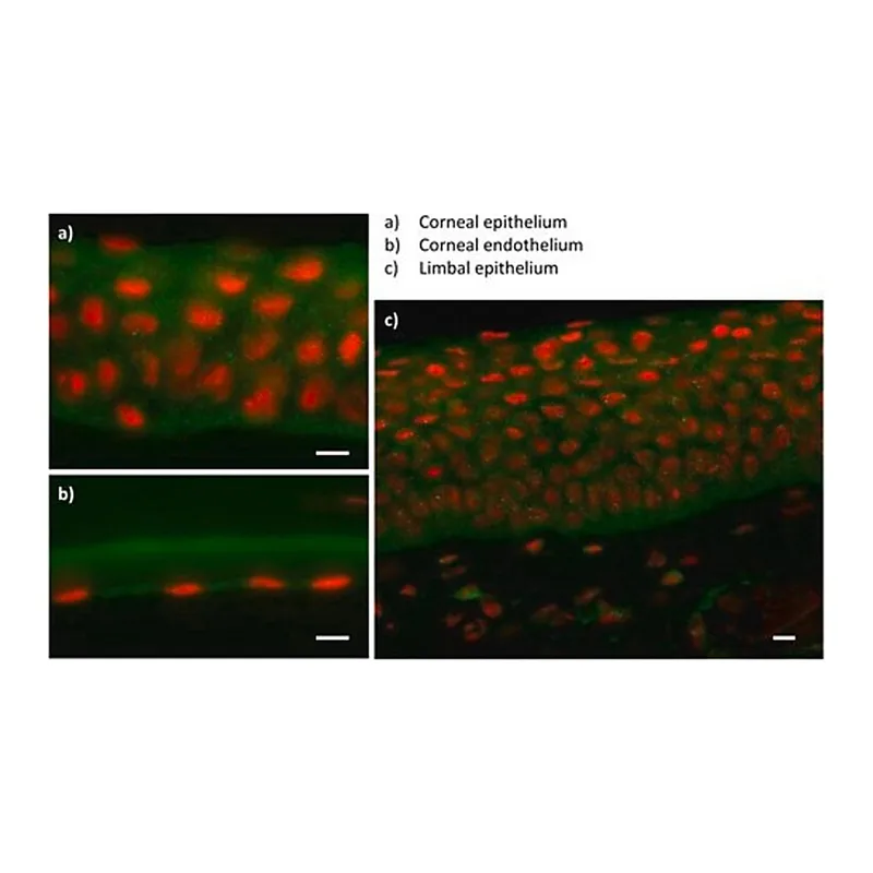 Merck Anti-ZEB1 antibody produced in rabbit
