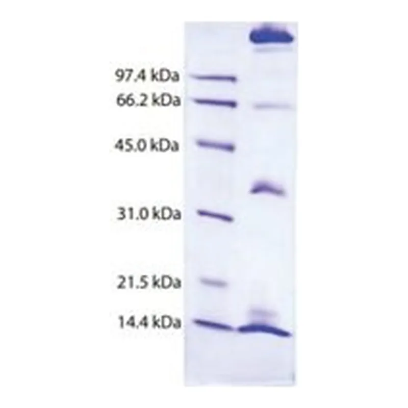Merck CHYLOMICRONS,HUMAN PLASMA