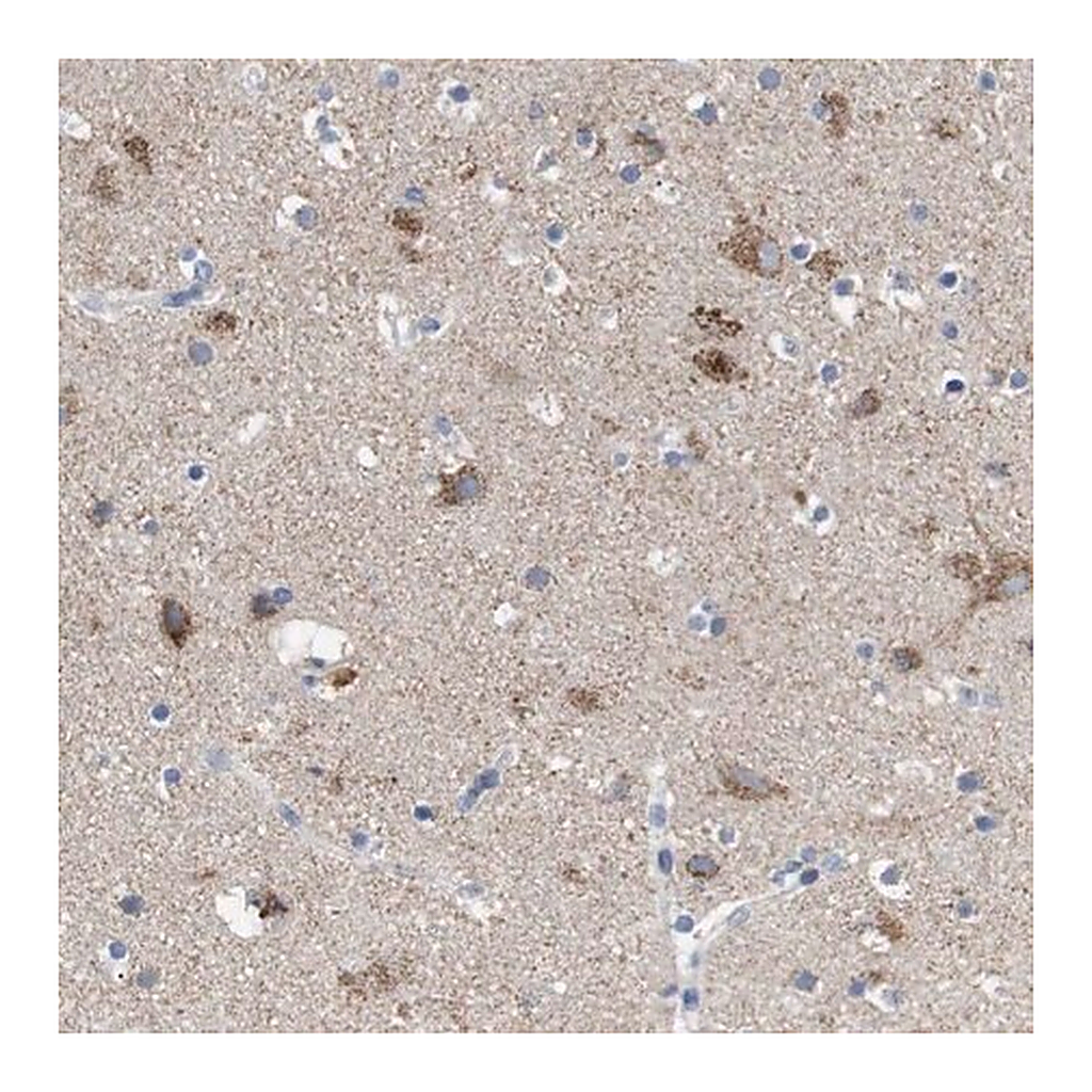 Merck Anti-LRRC55 antibody produced in rabbit