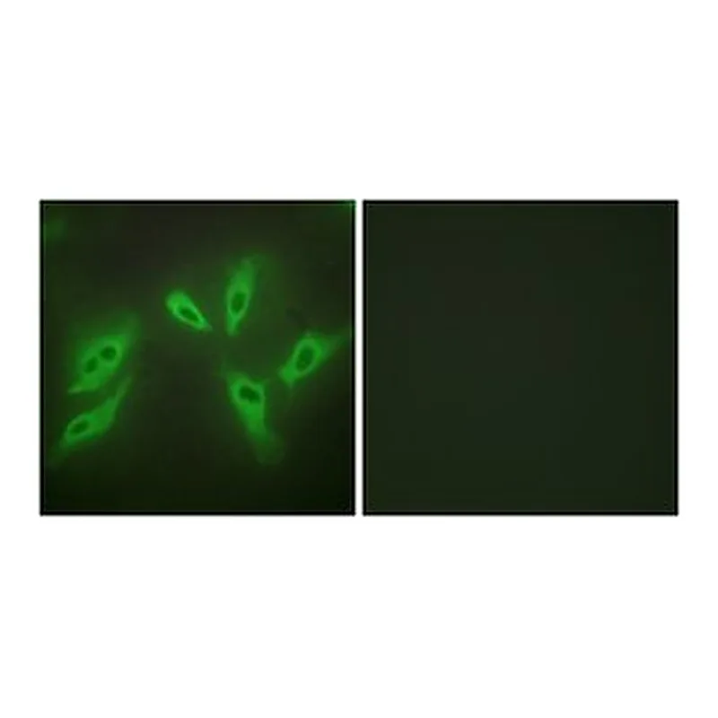 Merck ANTI-TUSC3