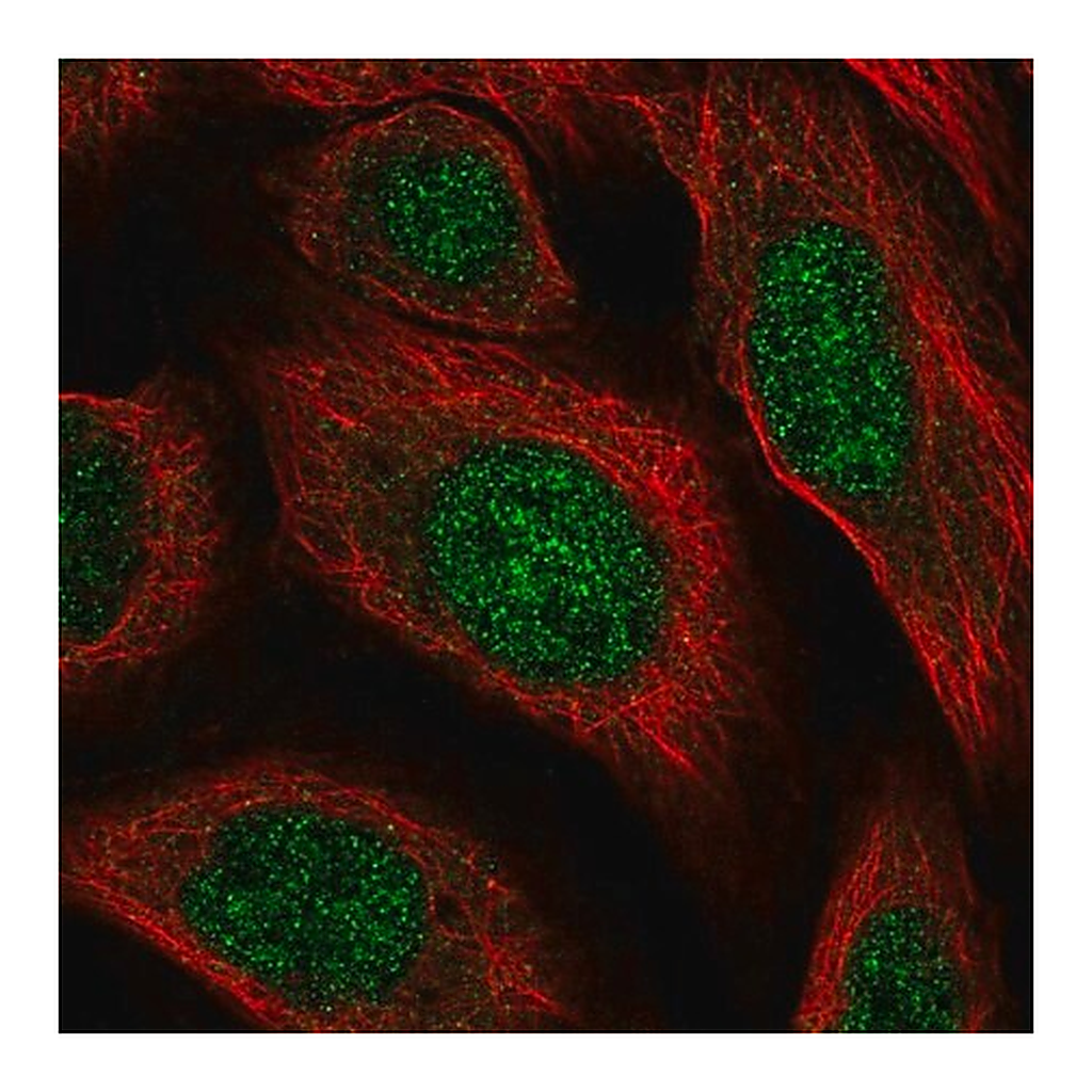 Merck Anti-HS6ST2 antibody produced in rabbit