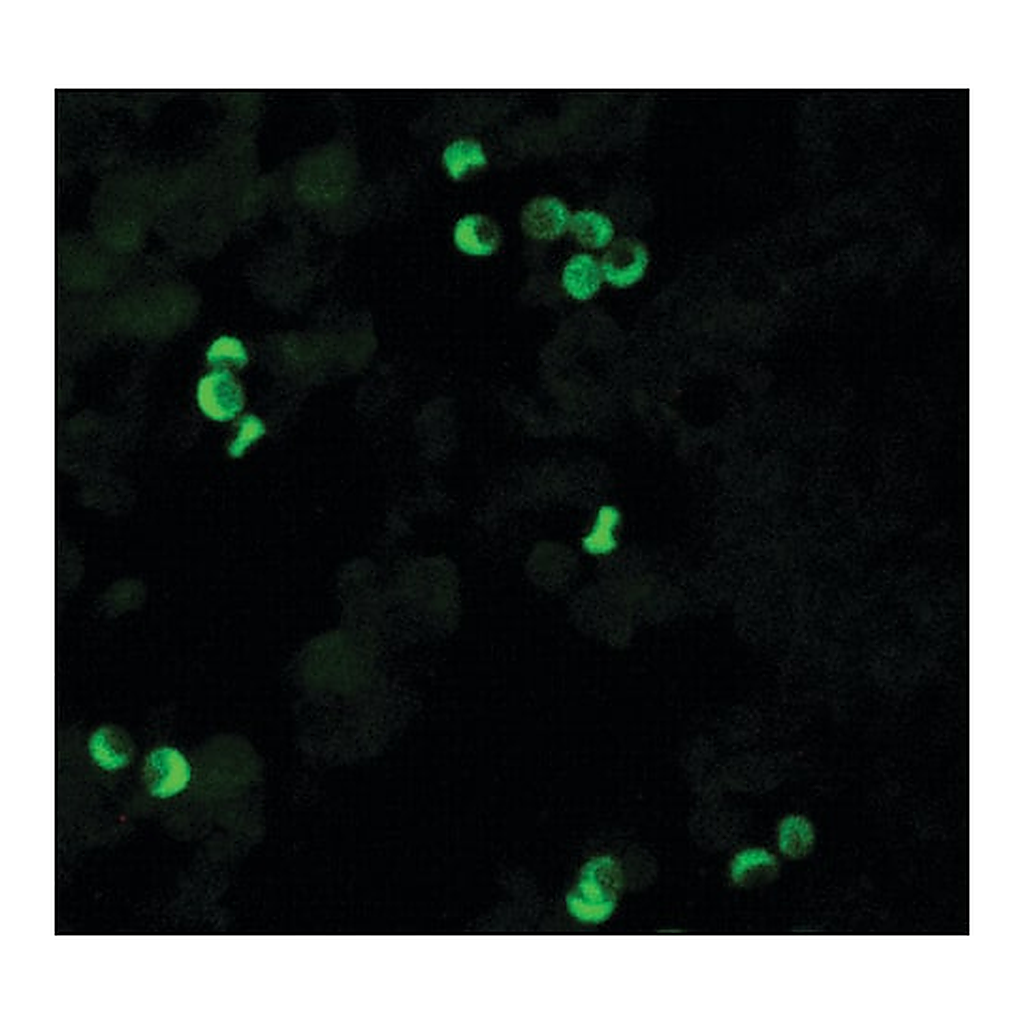 Merck Monoclonal Anti-HLA Class I Antigen antibody produced in mouse